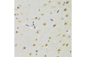 Immunohistochemistry of paraffin-embedded rat brain using DDB1 Antibody. (DDB1 Antikörper)