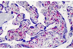 Human Placenta: Formalin-Fixed, Paraffin-Embedded (FFPE) (IKBKG Antikörper)