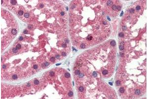 Human Kidney (formalin-fixed, paraffin-embedded) stained with IDH1 antibody ABIN462259 followed by biotinylated goat anti-rabbit IgG secondary antibody ABIN481713, alkaline phosphatase-streptavidin and chromogen. (IDH1 Antikörper  (AA 290-339))