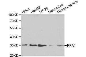 Western blot analysis of extracts of various cell lines, using PPA1 antibody. (Pyrophosphatase (Inorganic) 1 (PPA1) (AA 1-289) Antikörper)