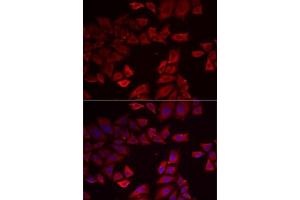 Immunofluorescence analysis of MCF7 cells using SEPHS1 antibody . (SEPHS1 Antikörper  (AA 1-392))