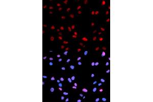 Immunofluorescence analysis of U2OS cells using Phospho-RB-S795 antibody (ABIN5969932). (Retinoblastoma 1 Antikörper  (pSer795))