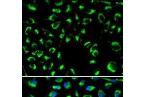 Immunofluorescence analysis of MCF-7 cells using PPP4C Polyclonal Antibody (PPP4C Antikörper)