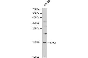 Western blot analysis of extracts of SW480 cells, using S antibody (ABIN3022330, ABIN3022331, ABIN3022332 and ABIN6218744) at 1:1000 dilution. (SAA1 Antikörper  (AA 19-122))