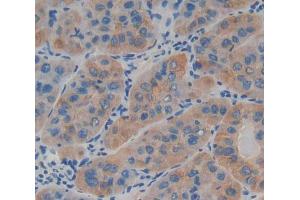 IHC-P analysis of Kidney tissue, with DAB staining. (LAMb4 Antikörper  (AA 1543-1759))