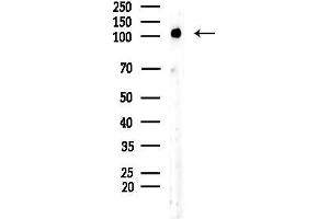 anti-Kinase Suppressor of Ras 2 (KSR2) (Internal Region) antibody