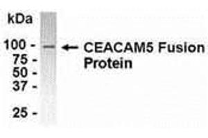 Western Blotting (WB) image for anti-Carcinoembryonic Antigen-Related Cell Adhesion Molecule 5 (CEACAM5) (AA 460-600) antibody (ABIN2468129) (CEACAM5 Antikörper  (AA 460-600))