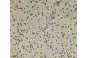 IHC-P analysis of Mouse Brain Tissue, with DAB staining. (CTGF Antikörper  (AA 245-346))