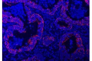 IF analysis of TRAM1L1 using anti-TRAM1L1 antibody (ABIN7602939). (TRAM1L1 Antikörper  (C-Term))