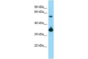 WB Suggested Anti-Bmi1 Antibody   Titration: 1.