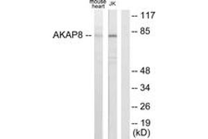 Western Blotting (WB) image for anti-A Kinase (PRKA) Anchor Protein 8 (AKAP8) (AA 331-380) antibody (ABIN2879134) (AKAP8 Antikörper  (AA 331-380))