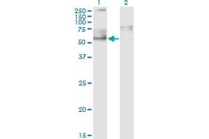 Western Blot analysis of IKZF5 expression in transfected 293T cell line by ZNFN1A5 monoclonal antibody (M01), clone 1B6. (IKZF5 Antikörper  (AA 2-100))