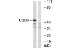 Western blot analysis of extracts from COLO cells, using UGDH Antibody. (UGDH Antikörper  (AA 391-440))