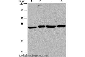 Western blot analysis of A431, HepG2, Raji and K562 cell, using CCR6 Polyclonal Antibody at dilution of 1:966 (CCR6 Antikörper)