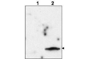 Western blot using  affinity purified anti-FIV Matrix Protein p15 to detect p15 in the culture supernatant of FIV-infected feline CrFK cells (lane 2, arrowhead).