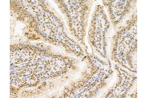 ABIN7094336 and ABIN7098383 at 1/100 staining Rat colon tissue by IHC-P.