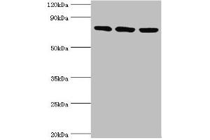 Western blot All lanes: DNA replication licensing factor MCM5 antibody at 3 μg/mL Lane 1: Hela whole cell lysate Lane 2: MCF-7 whole cell lysate Lane 2: Mouse thymus tissue Secondary Goat polyclonal to rabbit IgG at 1/10000 dilution Predicted band size: 82 kDa Observed band size: 82 kDa (MCM5 Antikörper  (AA 1-230))