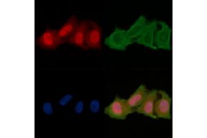ABIN6256701 and ABIN6278650 staining Hela cells(24h of starvation treatment) by IF/ICC. (CSNK1A1 Antikörper  (pTyr294))