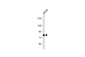 Anti-PKC theta Antibody (C-term) at 1:2000 dilution + Jurkat whole cell lysate Lysates/proteins at 20 μg per lane. (PKC theta Antikörper  (C-Term))