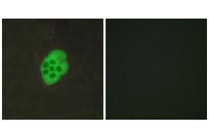 Immunofluorescence analysis of MCF-7 cells, using HTR4 antibody. (Serotonin Receptor 4 Antikörper  (Internal Region))