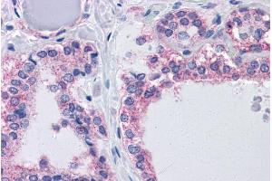 ABIN570975 (3. (AGAP2 Antikörper  (Internal Region))