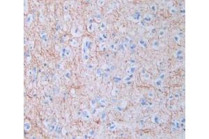 DAB staining on IHC-P; Samples: Human Brain Tissue (Amphiregulin Antikörper  (AA 20-100))