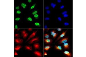 Immunofluorescence of Histone H3 [ac Lys9/phosphor Ser10]: Histone H3 K9-Ac/pS10 antibody was tested in HeLa cells with DyLight 488 (green).
