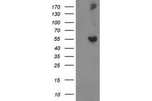 Western Blotting (WB) image for anti-Glucosidase, Beta, Acid 3 (Cytosolic) (GBA3) (AA 1-150), (AA 370-469) antibody (ABIN1490585) (GBA3 Antikörper  (AA 1-150, AA 370-469))
