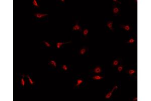 ABIN6268972 staining K-562 cells by IF/ICC. (Cyclin H Antikörper  (pThr315))
