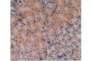 IHC-P analysis of Mouse Kidney Tissue, with DAB staining. (PZP Antikörper  (AA 1224-1495))
