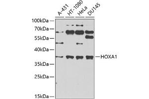 Western blot analysis of extracts of various cell lines, using HOX antibody (ABIN6131766, ABIN6141930, ABIN6141931 and ABIN6222663) at 1:1000 dilution.