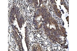 IHC analysis of NR3C1 using anti-NR3C1 antibody (ABIN3043453).