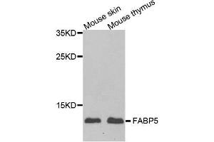 Western blot analysis of extracts of various cell lines, using FABP5 antibody. (FABP5 Antikörper  (AA 1-135))