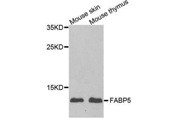 FABP5 anticorps  (AA 1-135)