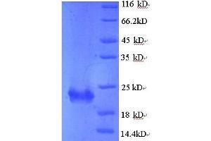 SDS-PAGE (SDS) image for Kruppel-Like Factor 6 (KLF6) (AA 27-207) protein (His tag) (ABIN4975150) (KLF6 Protein (AA 27-207) (His tag))