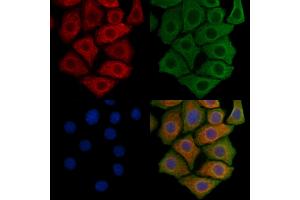 ABIN6260494 and ABIN6269220 staining Hela cells by IF/ICC. (beta Catenin Antikörper  (N-Term))