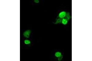 Anti-UBE2T mouse monoclonal antibody (ABIN2453760) immunofluorescent staining of COS7 cells transiently transfected by pCMV6-ENTRY UBE2T (RC200748). (Ube2t Antikörper)