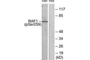 Western blot analysis of extracts from K562 cells, using C-RAF (Phospho-Ser259) Antibody. (RAF1 Antikörper  (AA 225-274))