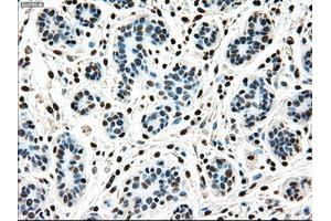 Immunohistochemistry (IHC) image for anti-Mitogen-Activated Protein Kinase Kinase 4 (MAP2K4) antibody (ABIN1499482) (MAP2K4 Antikörper)