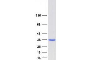 Western Blotting (WB) image for MAX-Like Protein X (MLX) (Transcript Variant 1) protein (Myc-DYKDDDDK Tag) (ABIN2725574)