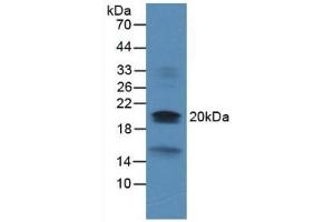 Detection of DUSP3 in Rat Heart Tissue using Monoclonal Antibody to Dual Specificity Phosphatase 3 (DUSP3) (Dual Specificity Phosphatase 3 (DUSP3) (AA 2-185) Antikörper)