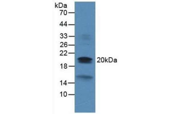 Dual Specificity Phosphatase 3 (DUSP3) (AA 2-185) Antikörper