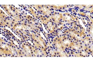 Immunohistochemistry (IHC) image for anti-Matrix Metallopeptidase 3 (Stromelysin 1, Progelatinase) (MMP3) (AA 278-450) antibody (ABIN7431008)