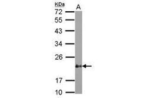 Image no. 1 for anti-Cysteine and Glycine-Rich Protein 2 (CSRP2) (AA 10-193) antibody (ABIN1497665) (CSRP2 Antikörper  (AA 10-193))