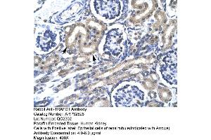 Immunohistochemistry (IHC) image for anti-TRAF-Type Zinc Finger Domain Containing 1 (TRAFD1) (C-Term) antibody (ABIN2777613)