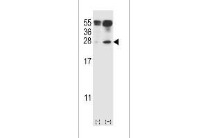 Western blot analysis of IL27 (arrow) using rabbit polyclonal IL27 Antibody (C71) (ABIN388443 and ABIN2848726). (IL-27 Antikörper  (AA 57-87))