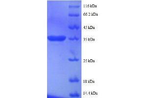 SDS-PAGE (SDS) image for Small Nuclear Ribonucleoprotein Polypeptide G (SNRPG) (AA 1-76), (full length) protein (GST tag) (ABIN618759)
