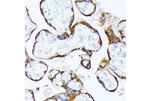 Immunohistochemistry of paraffin-embedded human placenta using Casein Kinase 1 alpha (Casein Kinase 1 alpha (CSNK1)) antibody (6225) at dilution of 1:100 (40x lens). (CSNK1A1 Antikörper  (AA 100-200))