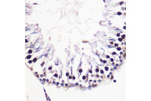 Immunohistochemistry (IHC) image for anti-H2A Histone Family, Member V (H2AFV) (AA 1-128) antibody (ABIN7267555)