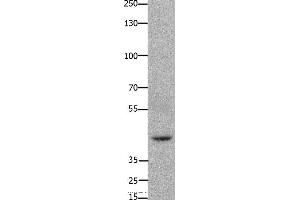 Western blot analysis of 293T cell, using FOXD3 Polyclonal Antibody at dilution of 1:650 (FOXD3 Antikörper)